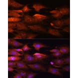 Immunofluorescence - Anti-N WASP Antibody (A14077) - Antibodies.com