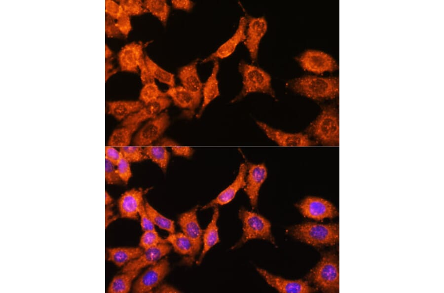 Immunofluorescence - Anti-N WASP Antibody (A14077) - Antibodies.com