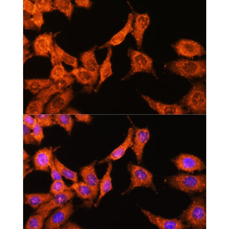 Immunofluorescence - Anti-N WASP Antibody (A14077) - Antibodies.com