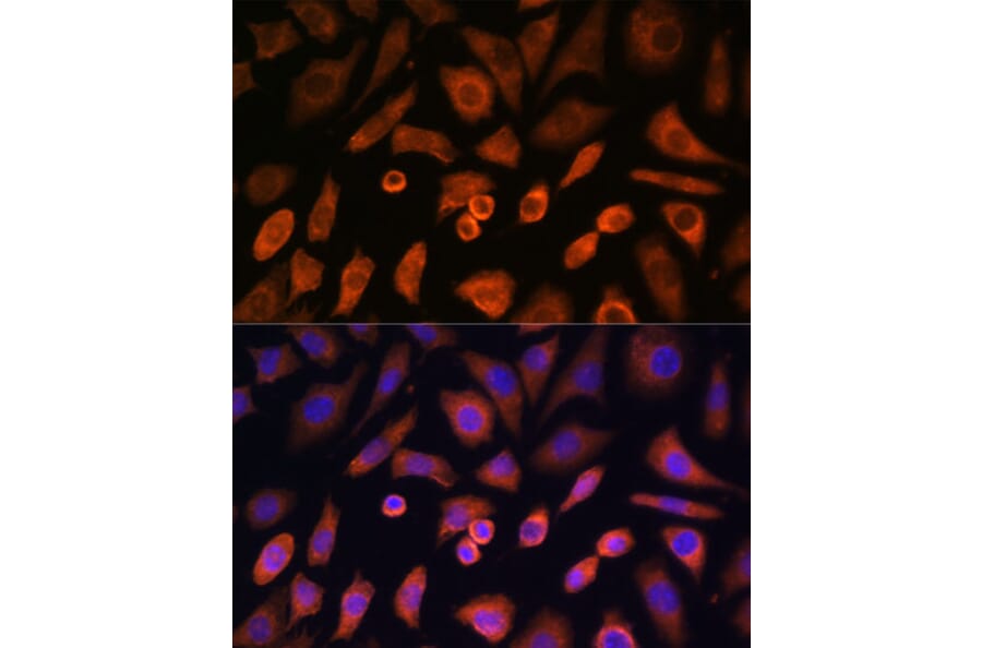 Immunofluorescence - Anti-N WASP Antibody (A14077) - Antibodies.com