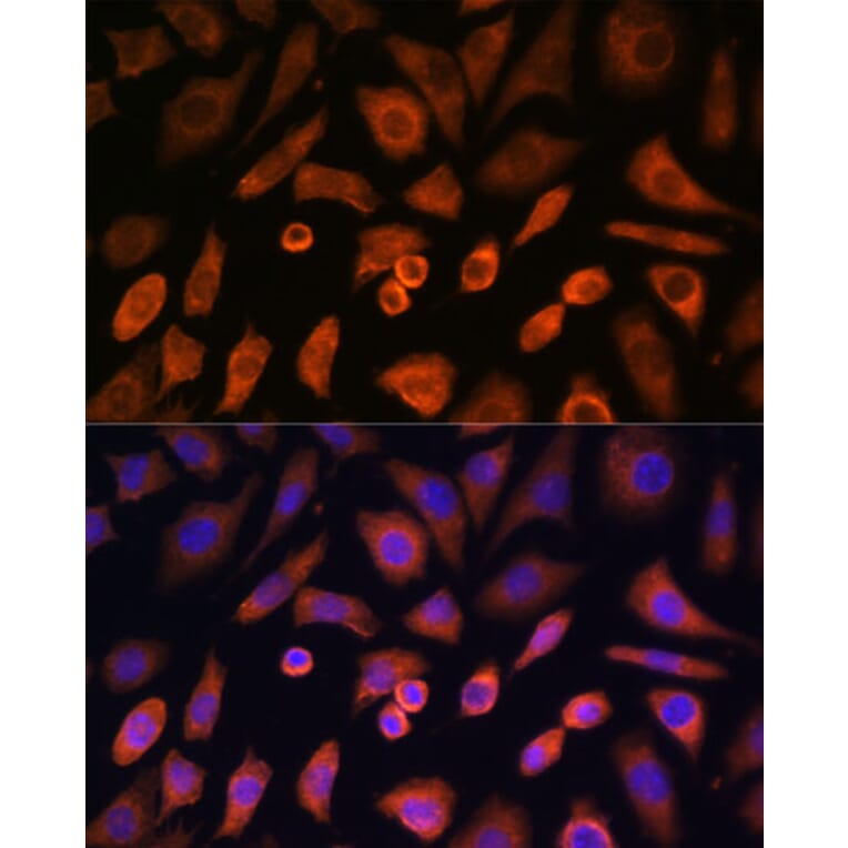 Immunofluorescence - Anti-N WASP Antibody (A14077) - Antibodies.com