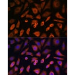 Immunofluorescence - Anti-N WASP Antibody (A14077) - Antibodies.com