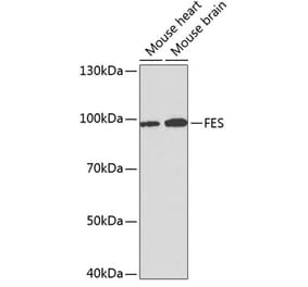 Western Blot - Anti-FES Antibody (A14078) - Antibodies.com