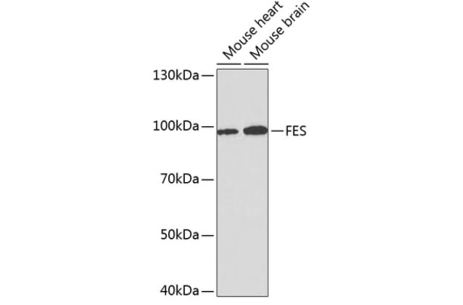 Western Blot - Anti-FES Antibody (A14078) - Antibodies.com