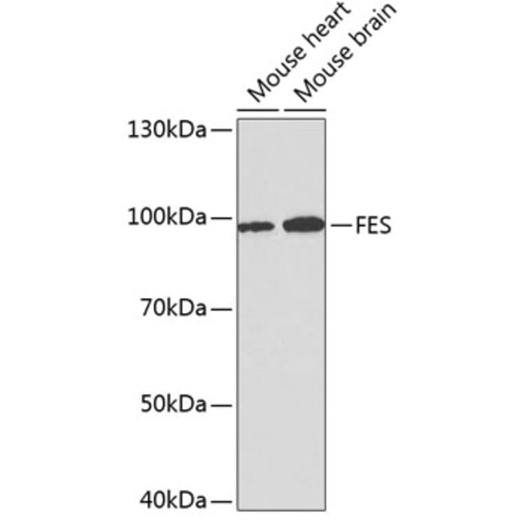 Western Blot - Anti-FES Antibody (A14078) - Antibodies.com