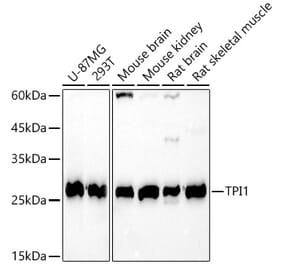 Western Blot - Anti-Triosephosphate isomerase Antibody (A14079) - Antibodies.com