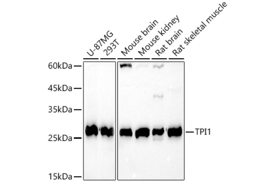 Western Blot - Anti-Triosephosphate isomerase Antibody (A14079) - Antibodies.com