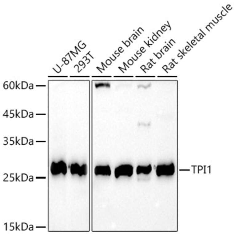 Western Blot - Anti-Triosephosphate isomerase Antibody (A14079) - Antibodies.com