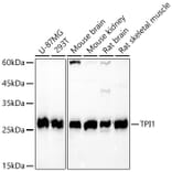 Western Blot - Anti-Triosephosphate isomerase Antibody (A14079) - Antibodies.com