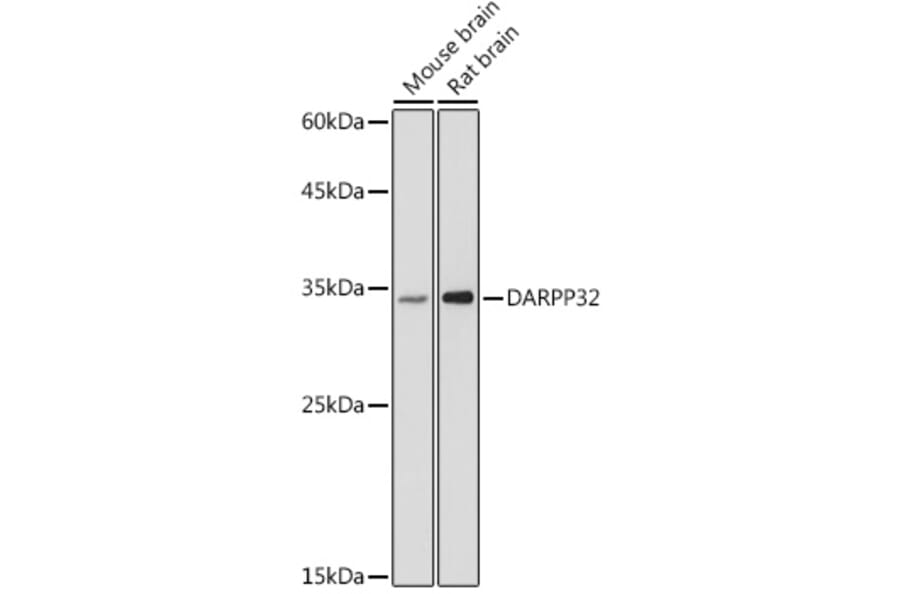Western Blot - Anti-DARPP32 Antibody (A14080) - Antibodies.com