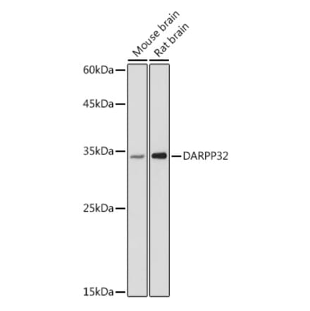 Western Blot - Anti-DARPP32 Antibody (A14080) - Antibodies.com