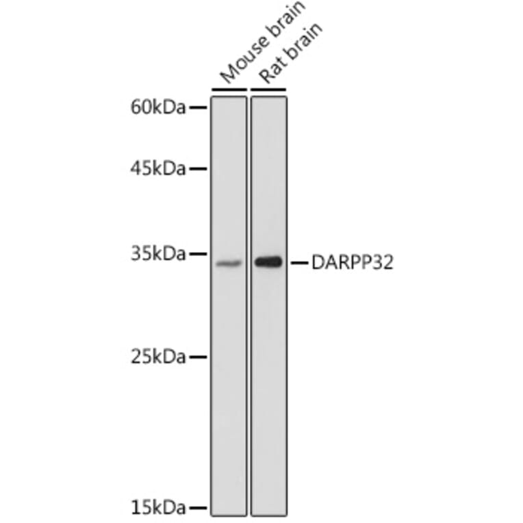 Western Blot - Anti-DARPP32 Antibody (A14080) - Antibodies.com