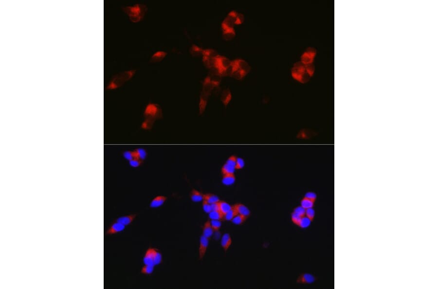 Immunofluorescence - Anti-DARPP32 Antibody (A14080) - Antibodies.com