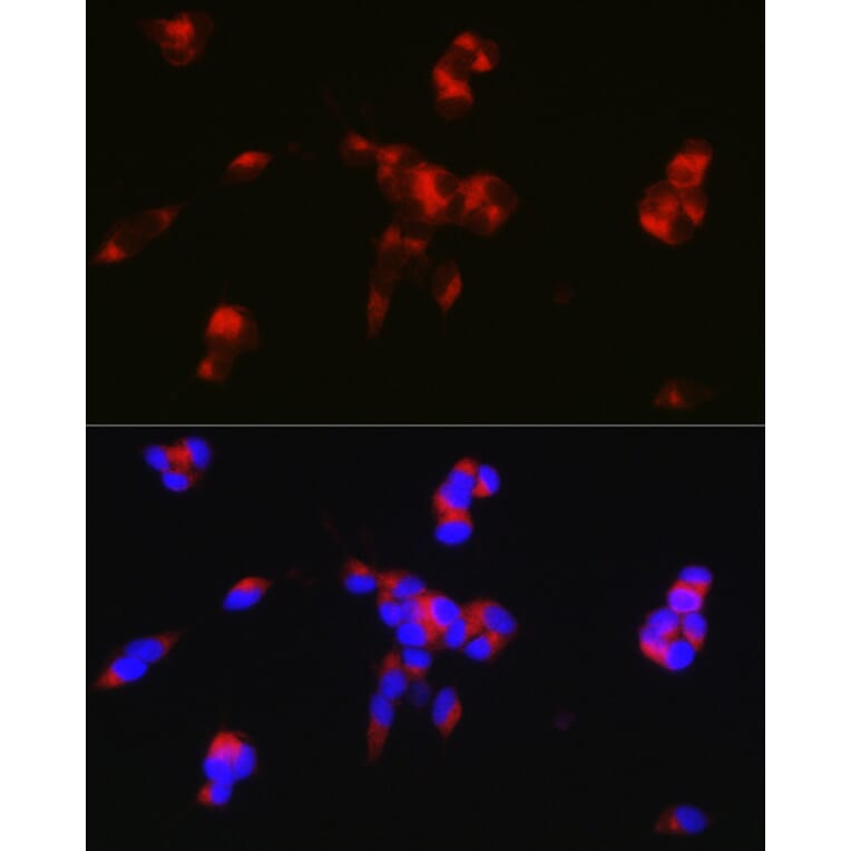 Immunofluorescence - Anti-DARPP32 Antibody (A14080) - Antibodies.com