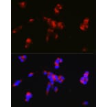 Immunofluorescence - Anti-DARPP32 Antibody (A14080) - Antibodies.com