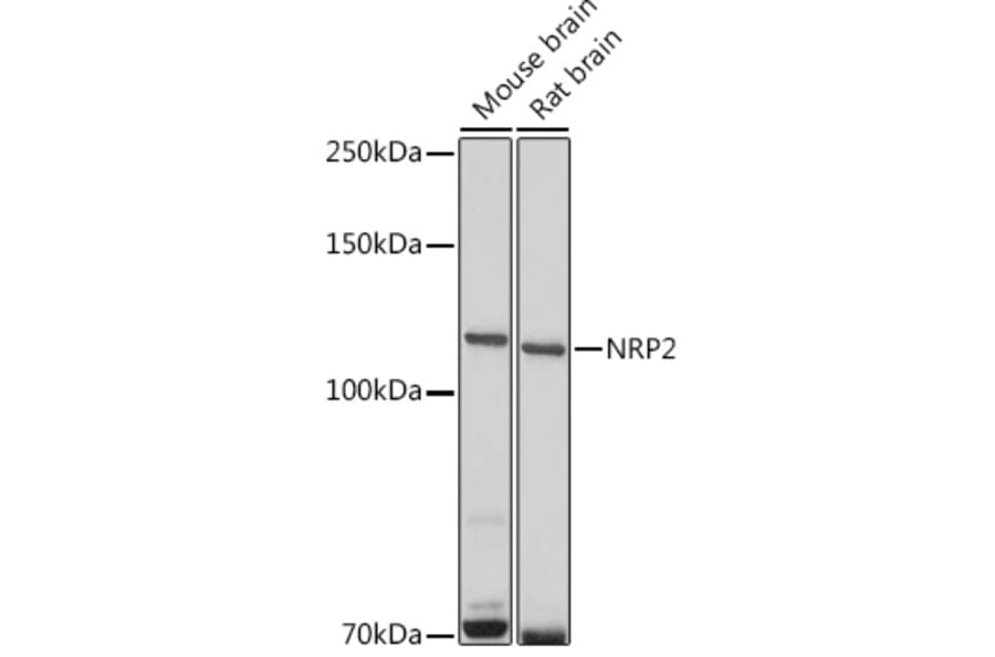 Western Blot - Anti-NRP2 Antibody (A14081) - Antibodies.com