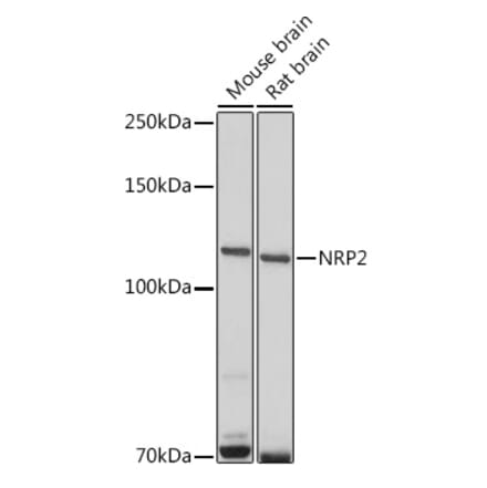 Western Blot - Anti-NRP2 Antibody (A14081) - Antibodies.com