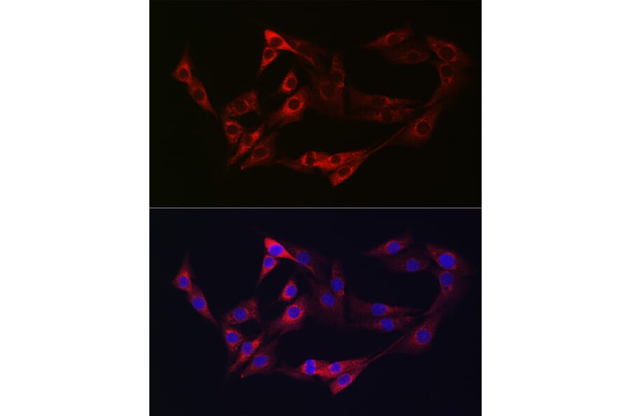Immunofluorescence - Anti-NRP2 Antibody (A14081) - Antibodies.com