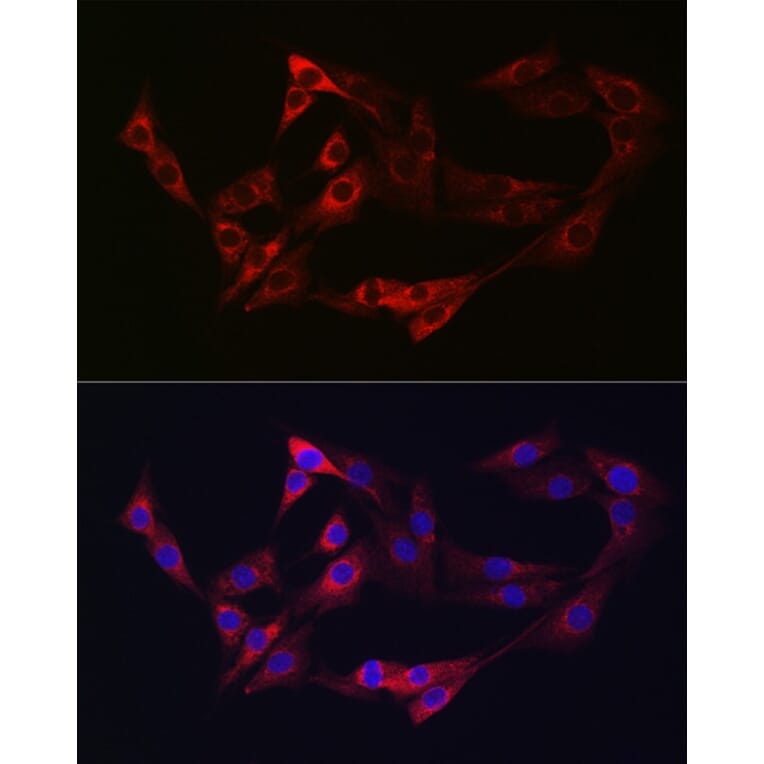Immunofluorescence - Anti-NRP2 Antibody (A14081) - Antibodies.com