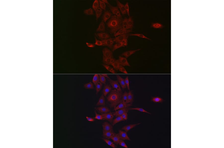 Immunofluorescence - Anti-NRP2 Antibody (A14081) - Antibodies.com