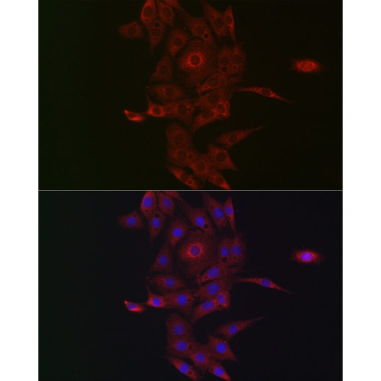 Immunofluorescence - Anti-NRP2 Antibody (A14081) - Antibodies.com