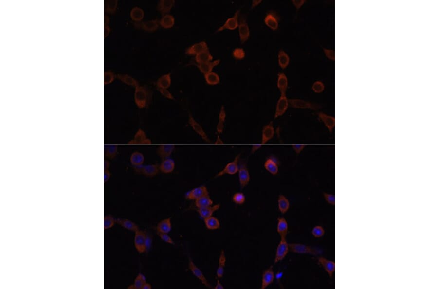 Anti-LAMP1 Antibody (A14082) | Antibodies.com