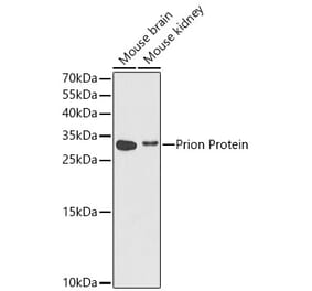 Western Blot - Anti-Prion protein PrP Antibody (A14083) - Antibodies.com