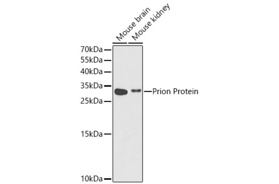 Western Blot - Anti-Prion protein PrP Antibody (A14083) - Antibodies.com