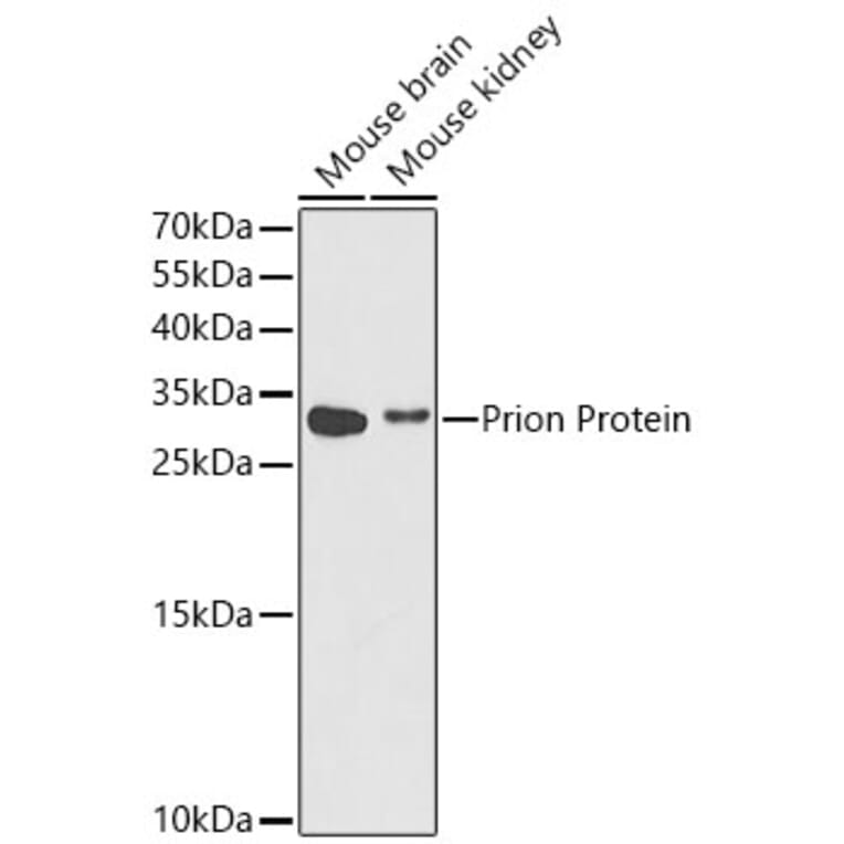 Western Blot - Anti-Prion protein PrP Antibody (A14083) - Antibodies.com