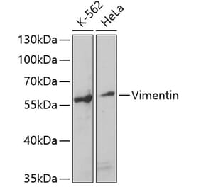 Western Blot - Anti-Vimentin Antibody (A14084) - Antibodies.com