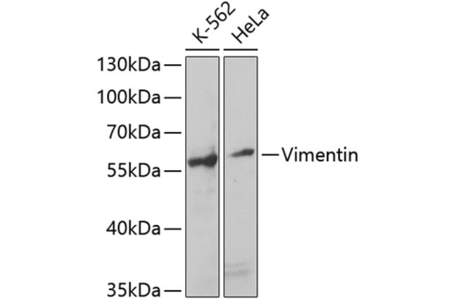 Western Blot - Anti-Vimentin Antibody (A14084) - Antibodies.com