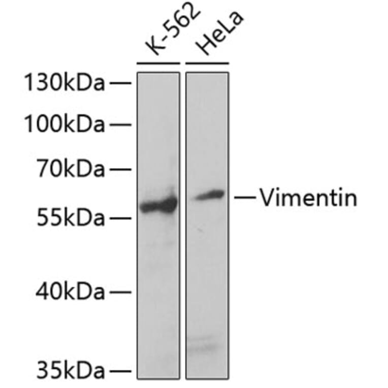 Western Blot - Anti-Vimentin Antibody (A14084) - Antibodies.com