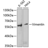 Western Blot - Anti-Vimentin Antibody (A14084) - Antibodies.com