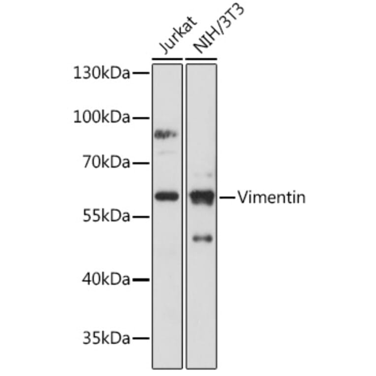 Western Blot - Anti-Vimentin Antibody (A14084) - Antibodies.com