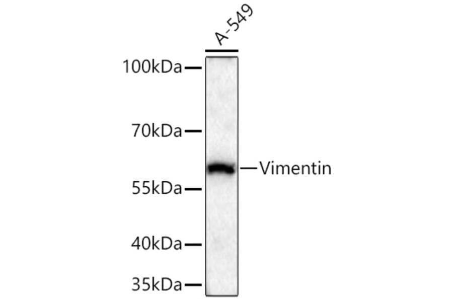 Western Blot - Anti-Vimentin Antibody (A14084) - Antibodies.com
