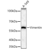 Western Blot - Anti-Vimentin Antibody (A14084) - Antibodies.com