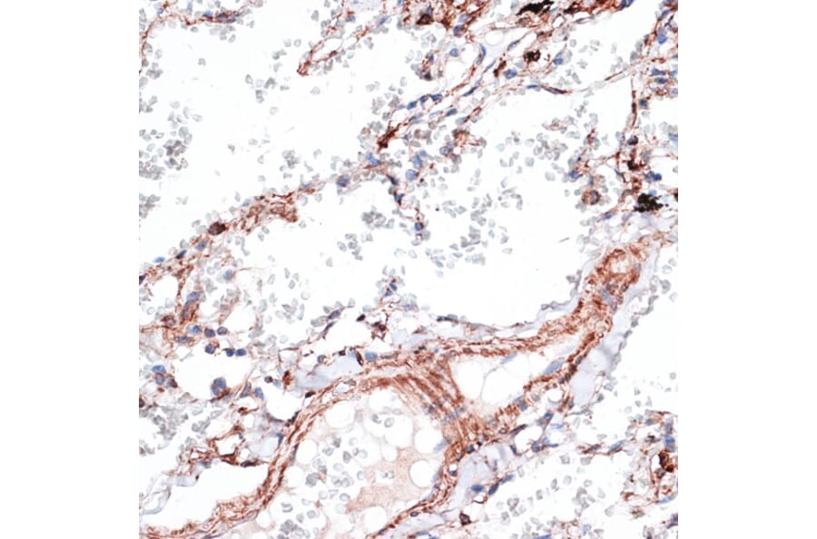 Immunohistochemistry - Anti-Vimentin Antibody (A14084) - Antibodies.com