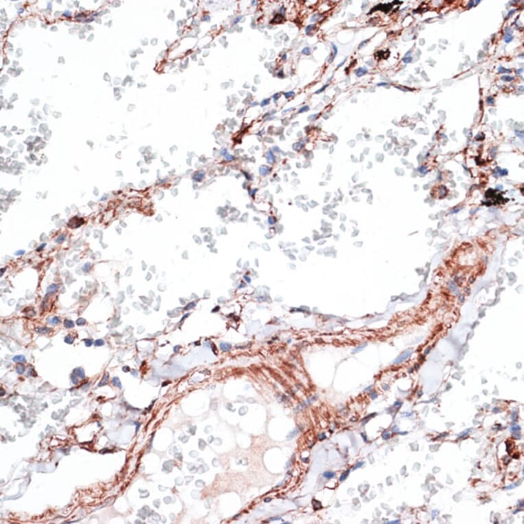 Immunohistochemistry - Anti-Vimentin Antibody (A14084) - Antibodies.com