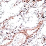 Immunohistochemistry - Anti-Vimentin Antibody (A14084) - Antibodies.com