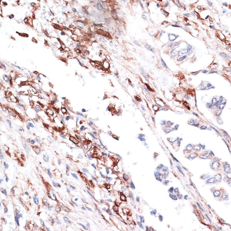Immunohistochemistry - Anti-Vimentin Antibody (A14084) - Antibodies.com