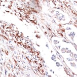 Immunohistochemistry - Anti-Vimentin Antibody (A14084) - Antibodies.com