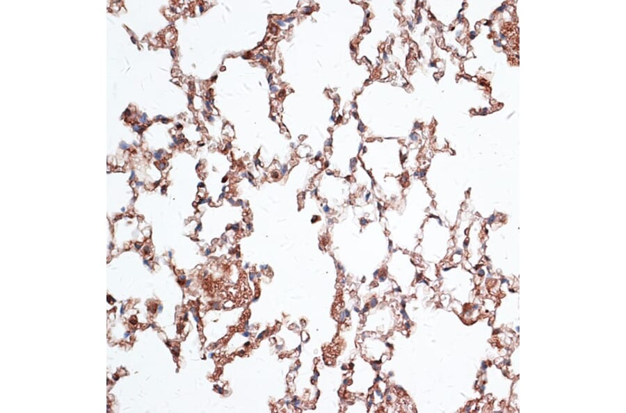 Immunohistochemistry - Anti-Vimentin Antibody (A14084) - Antibodies.com