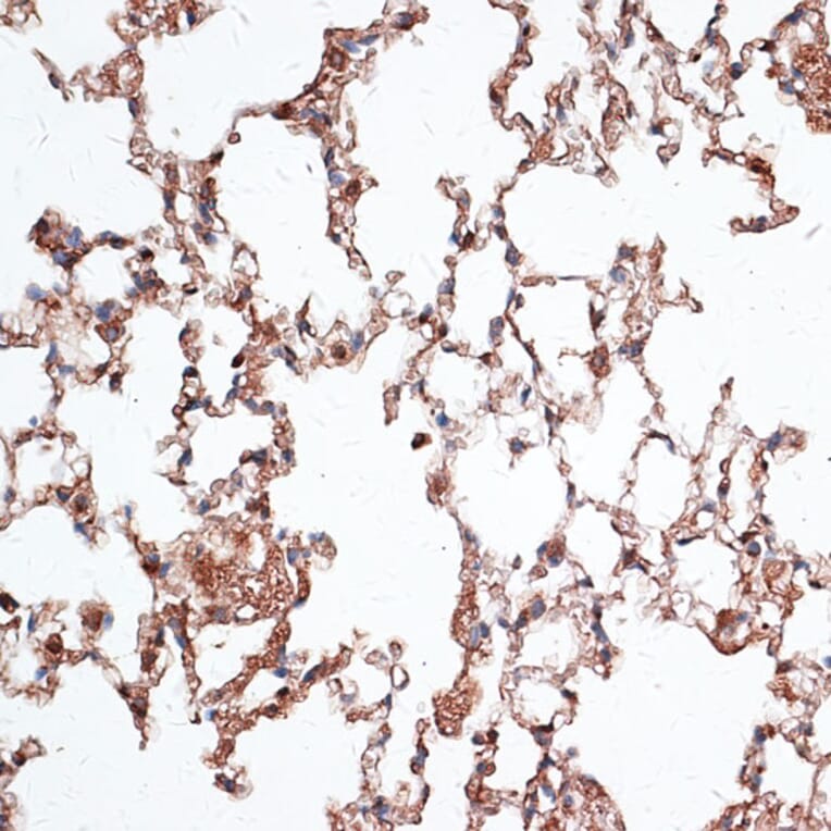 Immunohistochemistry - Anti-Vimentin Antibody (A14084) - Antibodies.com