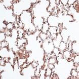 Immunohistochemistry - Anti-Vimentin Antibody (A14084) - Antibodies.com