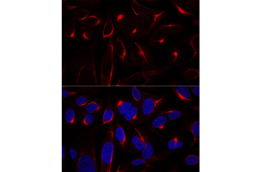 Immunofluorescence - Anti-Vimentin Antibody (A14084) - Antibodies.com