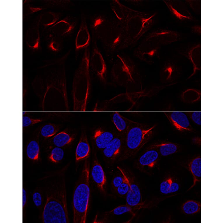 Immunofluorescence - Anti-Vimentin Antibody (A14084) - Antibodies.com