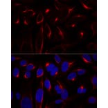 Immunofluorescence - Anti-Vimentin Antibody (A14084) - Antibodies.com