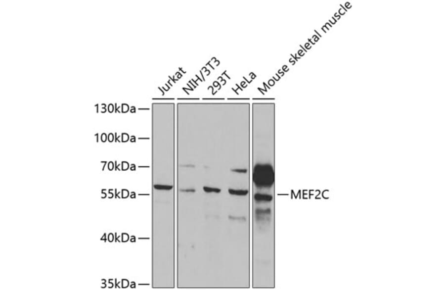 Western Blot - Anti-MEF2C Antibody (A14085) - Antibodies.com