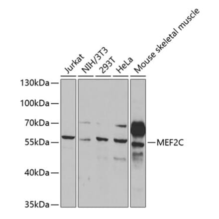 Western Blot - Anti-MEF2C Antibody (A14085) - Antibodies.com