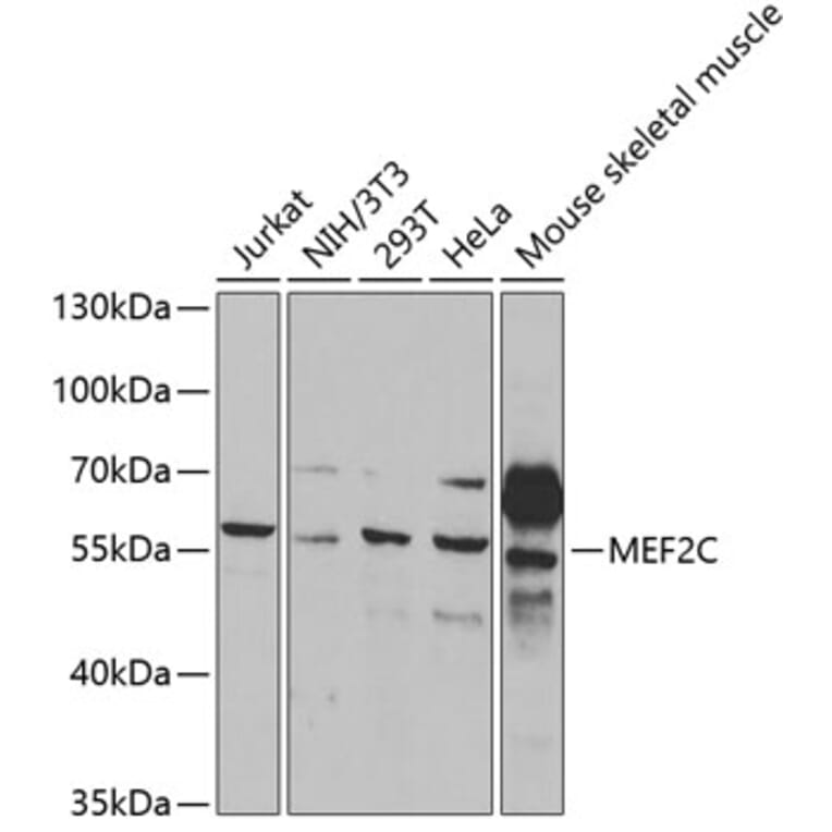 Western Blot - Anti-MEF2C Antibody (A14085) - Antibodies.com